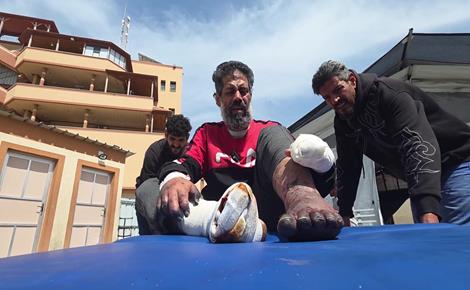 مصعب يواجه خطر فقدان أطرافه تدريجيًا مصعب يواجه خطر فقدان أطرافه تدريجيًا